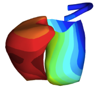 Novel electromechanical phenotypization of heart failure patients candidate for cardiac resynchronization therapy